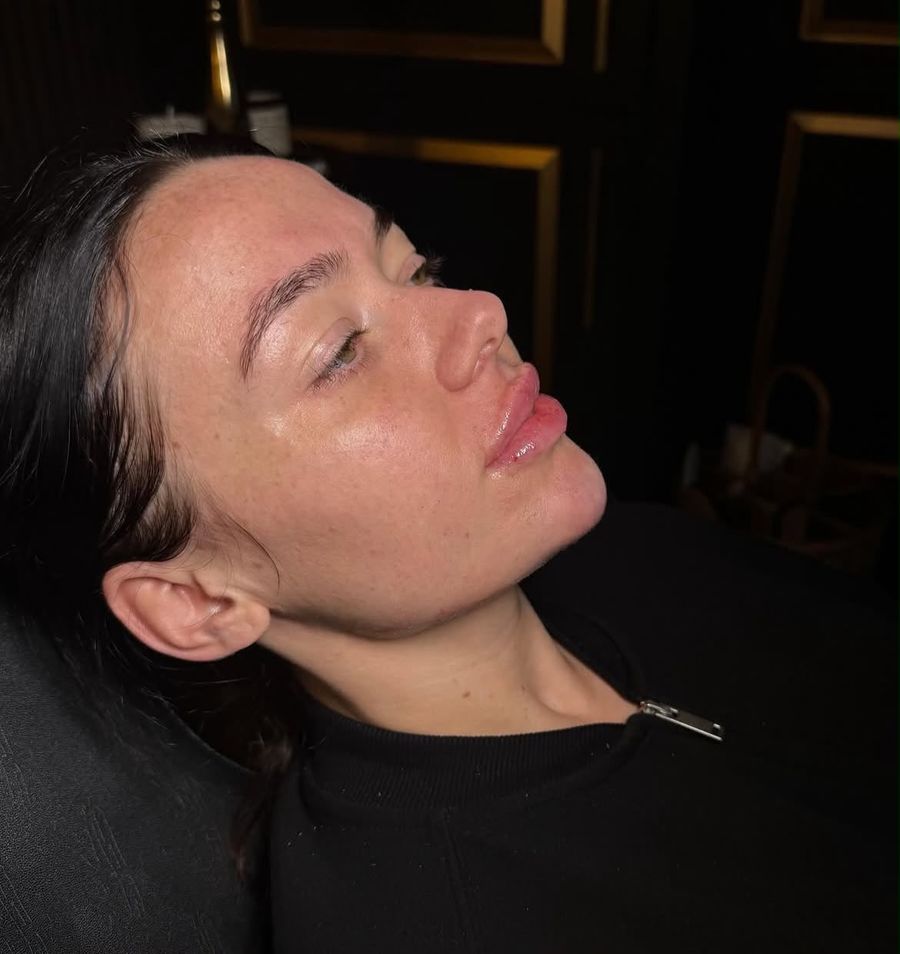 Client result after facial balancing